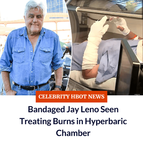 Jay Leno Uses Hyperbaric Oxygen Therapy for Third Degree Burns Jay Leno Uses Hyperbaric Oxygen Therapy for Third Degree Burns