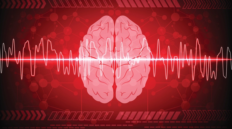 DID YOU KNOW A STROKE IS A BRAIN INJURY?