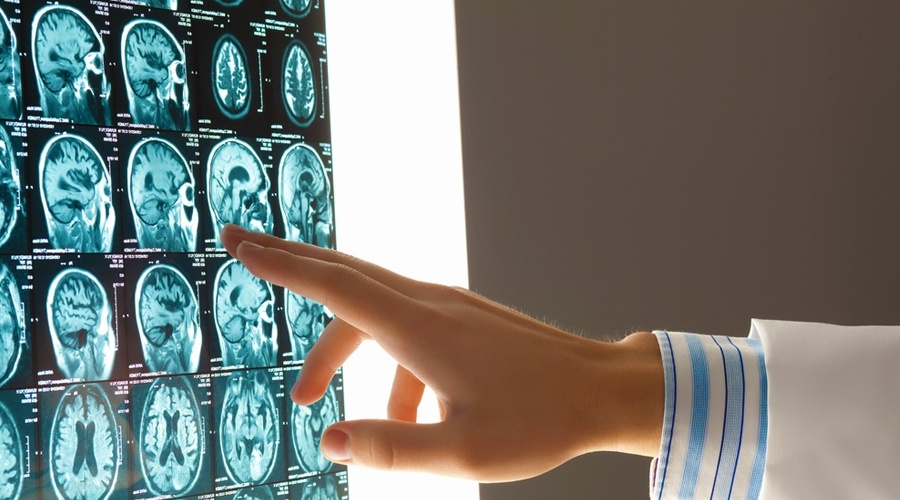 HBOT BECOMING INCREASINGLY POPULAR BRAIN INJURY THERAPY