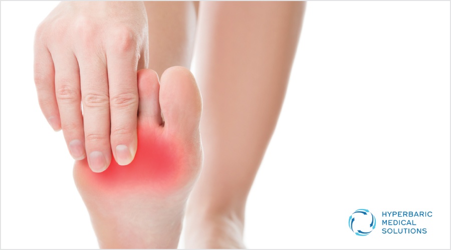 Hyperbaric Oxygen Therapy as a Diabetic Foot Ulcer Treatment