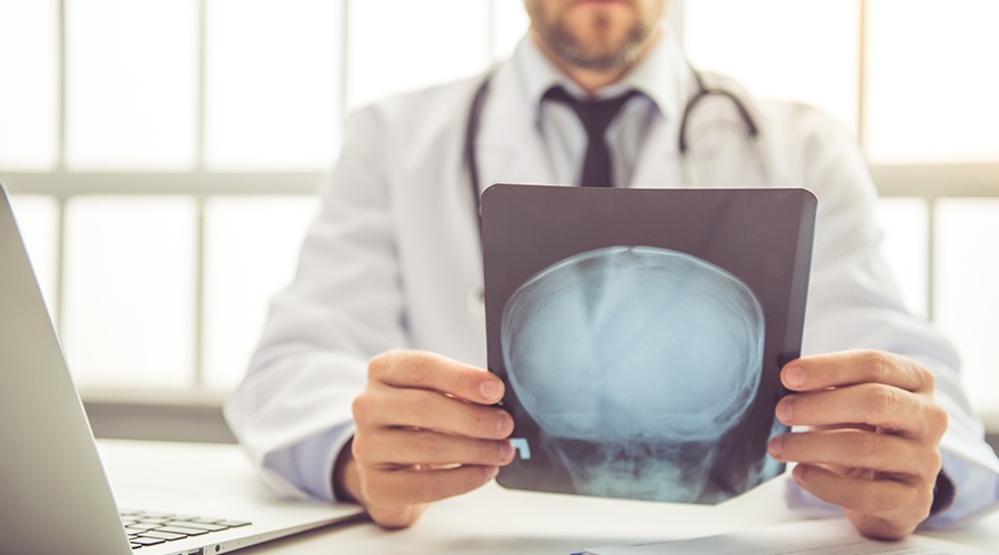 What to Do After a Concussion: 5 Tips What to Do After a Concussion: 5 Tips