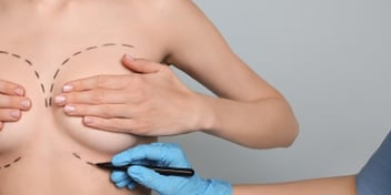 Breast reconstruction with hyperbaric oxygen therapy