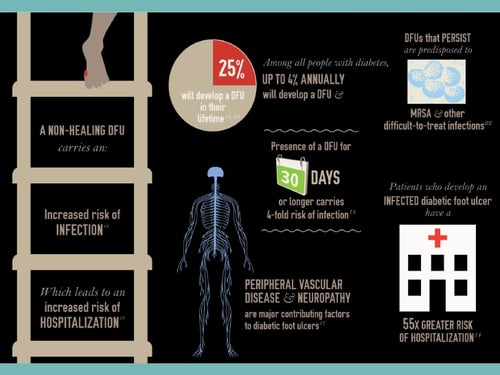 Diabetic Foot Ulcer Infographic 