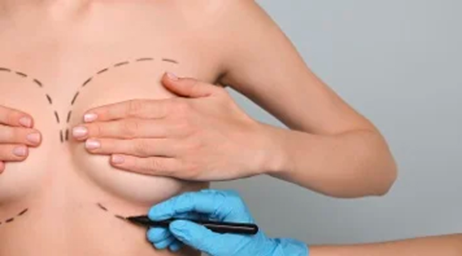 woman holding breasts preparing for exam