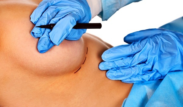 Breast Reconstruction Surgery Breast Reconstruction Surgery