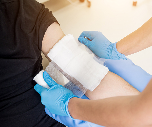 doctor bandaging a burn wound