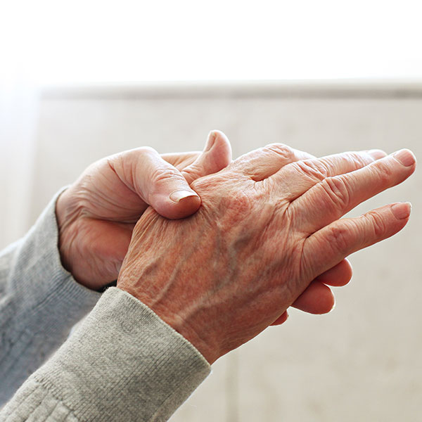 upclose of womans hands dealing with arthritis